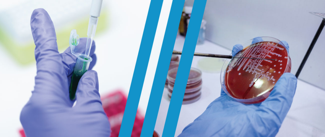 Side by side comparison of culture testing vs PCR testing.