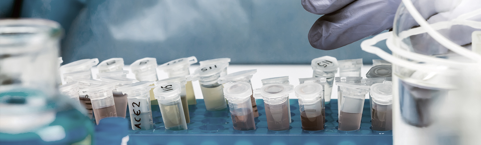 Covid-19 Wastewater testing